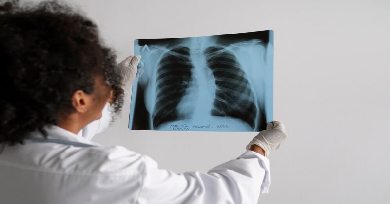 Ruqyah effect of lung cancer