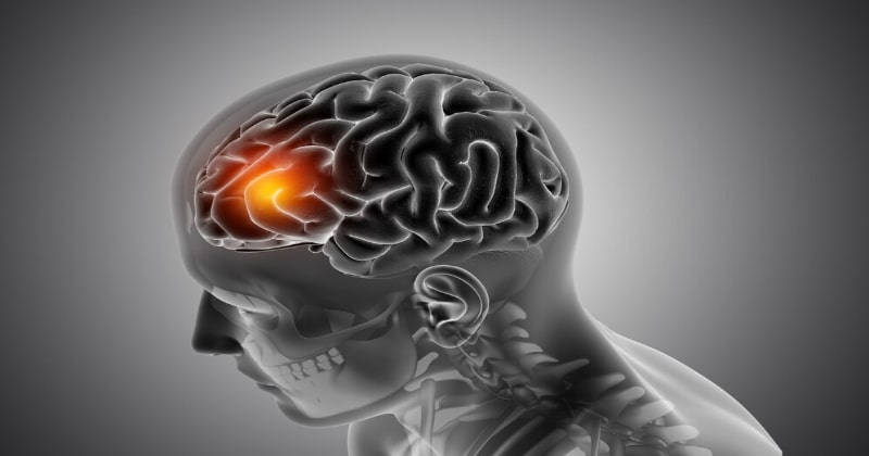 Ruqyah heals brain cancer